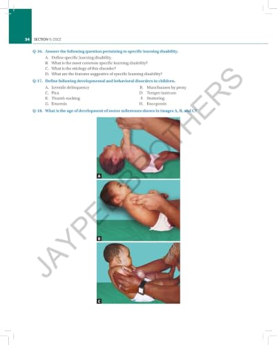 Essentials for PG Pediatric Exam: OSCE, Spotters, Viva and Procedures for DNB, MD, Diploma and MRCPCH Exams | 600+ OSCEs Across 26 Subjects | Spotter Diagnosis and Detailed Viva Q&A: 1