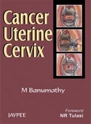 Cancer Uterine Cervix book cover