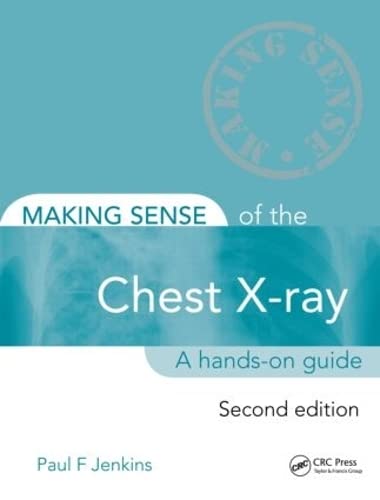 Making Sense of the Chest X-ray: A hands-on guide book cover