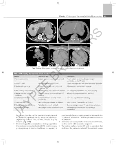 Textbook Of Radiology (For X-Ray,CT,MRI,BSc BRIT and MSc Technicians With Review Questions & Mcqs)