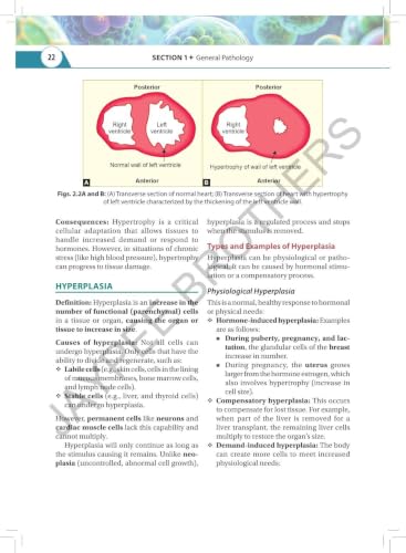 Textbook of Pathology & Genetics for Nurses, 3/E for BSc Nursing 3rd & 4th Semesters | General & Systemic Pathology, Hematology and Genetics with Chapter-wise MCQs, Flowcharts and Glossary