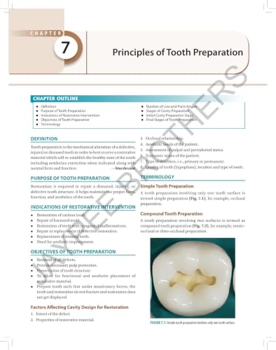 Textbook of Preclinical Conservative Dentistry, 4/E for 2nd Year BDS Students | Dental Caries, Materials, Cast Metal, Amalgam and Composite Restorations | Viva Questions and Glossary