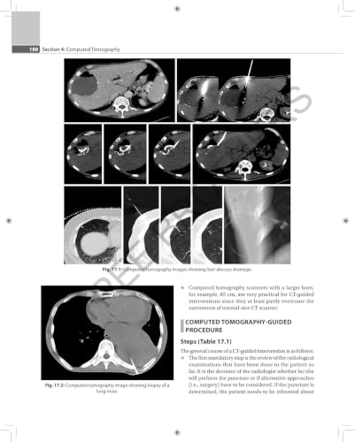 Textbook Of Radiology (For X-Ray,CT,MRI,BSc BRIT and MSc Technicians With Review Questions & Mcqs)