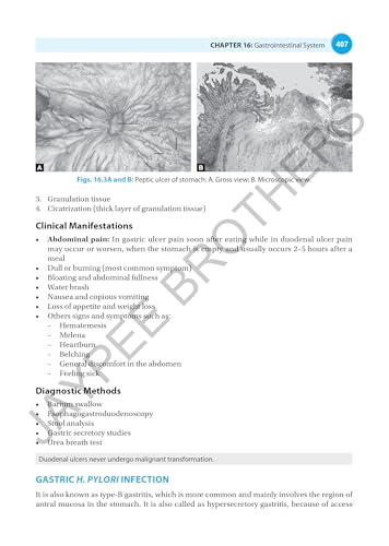 Textbook of Pharmacology & Pathology for Nurses-I