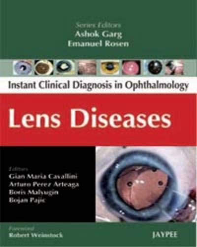 Instant Clinical Diagnosis in Ophthalmology: Lens Diseases book cover