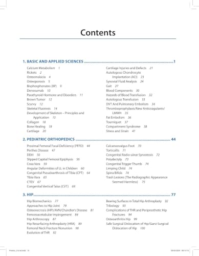 Orthopedic Exam Review, 2/E for MS, DNB & Diploma Orthopedic Postgraduates | 300+ PG Exam Questions with Hand-Drawn Flowcharts, Tables & Diagrams for ... A Comprehensive Manual for Postgraduates: 1
