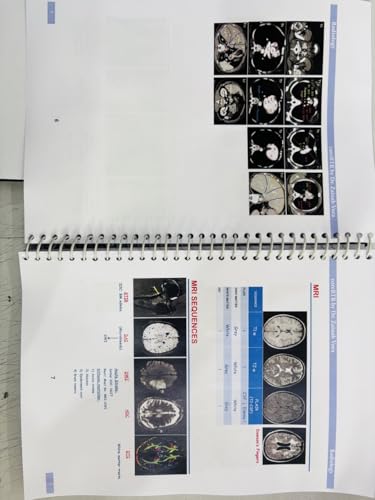 Core BTR Annotated Notes 3.0, Latest Edition 2026-2027, Set of 3 Books, for NEET PG, INICET, FMGE