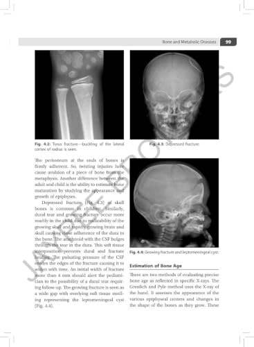 IAP Textbook of Pediatric Radiology