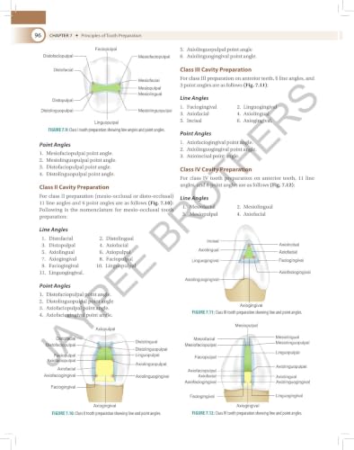 Textbook of Preclinical Conservative Dentistry, 4/E for 2nd Year BDS Students | Dental Caries, Materials, Cast Metal, Amalgam and Composite Restorations | Viva Questions and Glossary