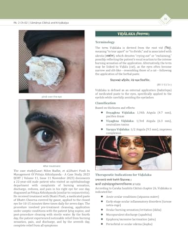 Shalakya Tantra Vol.1 (NCISM Syllabus) NETRA ROGA (OPHTHALMOLOGY) For BAMS 3rd Professional "As Per Ncism"