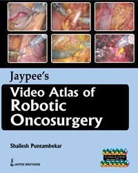 JaypeeS Video Atlas Of Robotic Oncosurgery book cover
