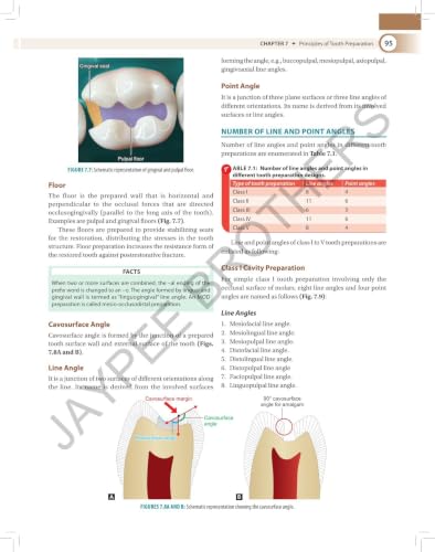 Textbook of Preclinical Conservative Dentistry, 4/E for 2nd Year BDS Students | Dental Caries, Materials, Cast Metal, Amalgam and Composite Restorations | Viva Questions and Glossary