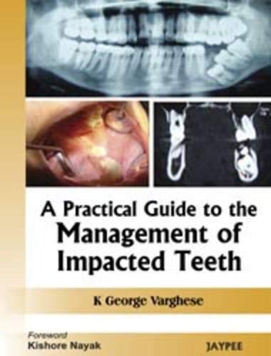 A Practical Guide to the Management of Impacted Teeth book cover