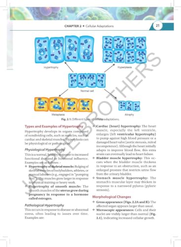 Textbook of Pathology & Genetics for Nurses, 3/E for BSc Nursing 3rd & 4th Semesters | General & Systemic Pathology, Hematology and Genetics with Chapter-wise MCQs, Flowcharts and Glossary