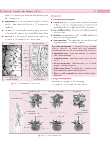 Illustrated Shalya Vigyan Part-2 (A Textbook of Ayurveda Surgery) Based on New NCISM Syllabus for BAMS Third Prof (English Medium)