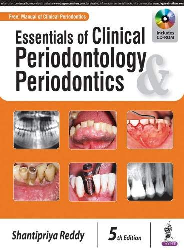 Essentials Of Clinical Periodontology Periodontics With Cd-Rom Free-Manual Of Clinical Periodontics by Shantipriya Reddy book cover