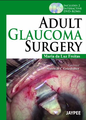 Adult Glaucoma Surgery includes 2 int.DVD-ROMs book cover