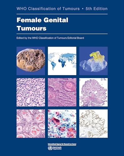 WHO classification of female genital tumours: Who Classification of Tumours: 4 (World Health Organization Classification of Tumours)