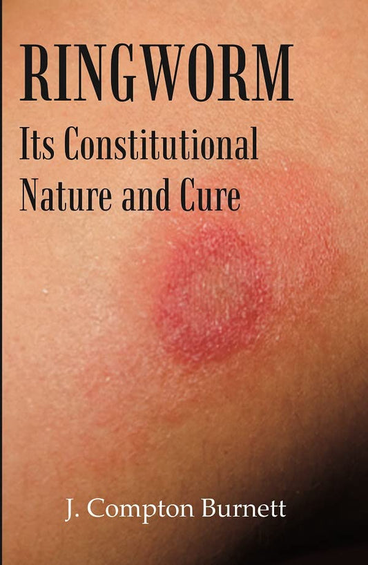 Ringworm: Its Constitutional Nature and Cure