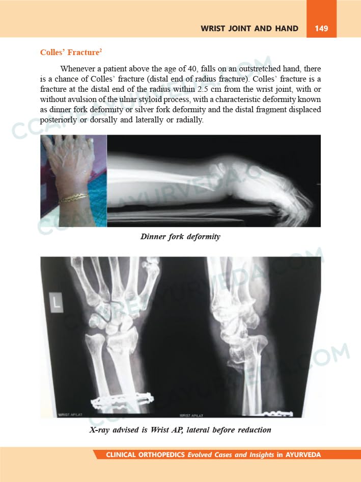 Clinical Orthopedics in Ayurveda (2nd Edition) - Evolved Cases and Insights by Dr Gikku Alias Benny MS (Ay): 2