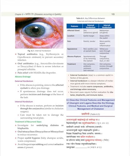 Illustrated Shalakya Tantra (Part-1 : Textbook of Ophthalmology) ???????-????? : ???-?? : ???????? ??????? (Hindi Edition) As per the new NCISM syllabus for BAMS Third Professional