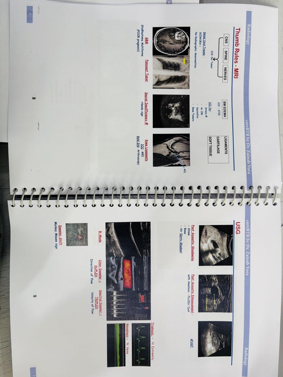 Core BTR Annotated Notes 3.0, Latest Edition 2026-2027, Set of 3 Books, for NEET PG, INICET, FMGE