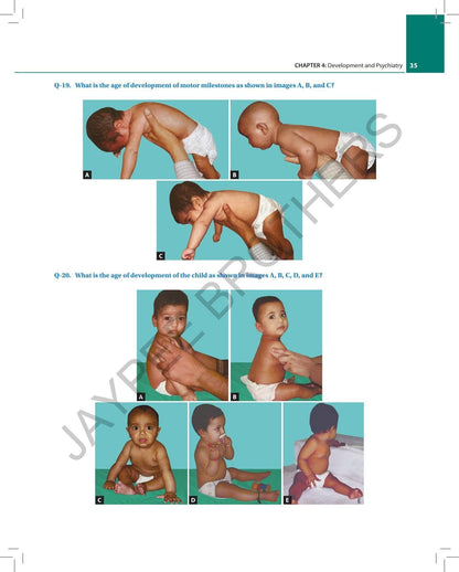 Essentials for PG Pediatric Exam: OSCE, Spotters, Viva and Procedures for DNB, MD, Diploma and MRCPCH Exams | 600+ OSCEs Across 26 Subjects | Spotter Diagnosis and Detailed Viva Q&A: 1