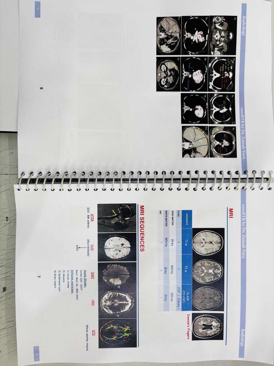 Core BTR Annotated Notes 3.0, Latest Edition 2026-2027, Set of 3 Books, for NEET PG, INICET, FMGE