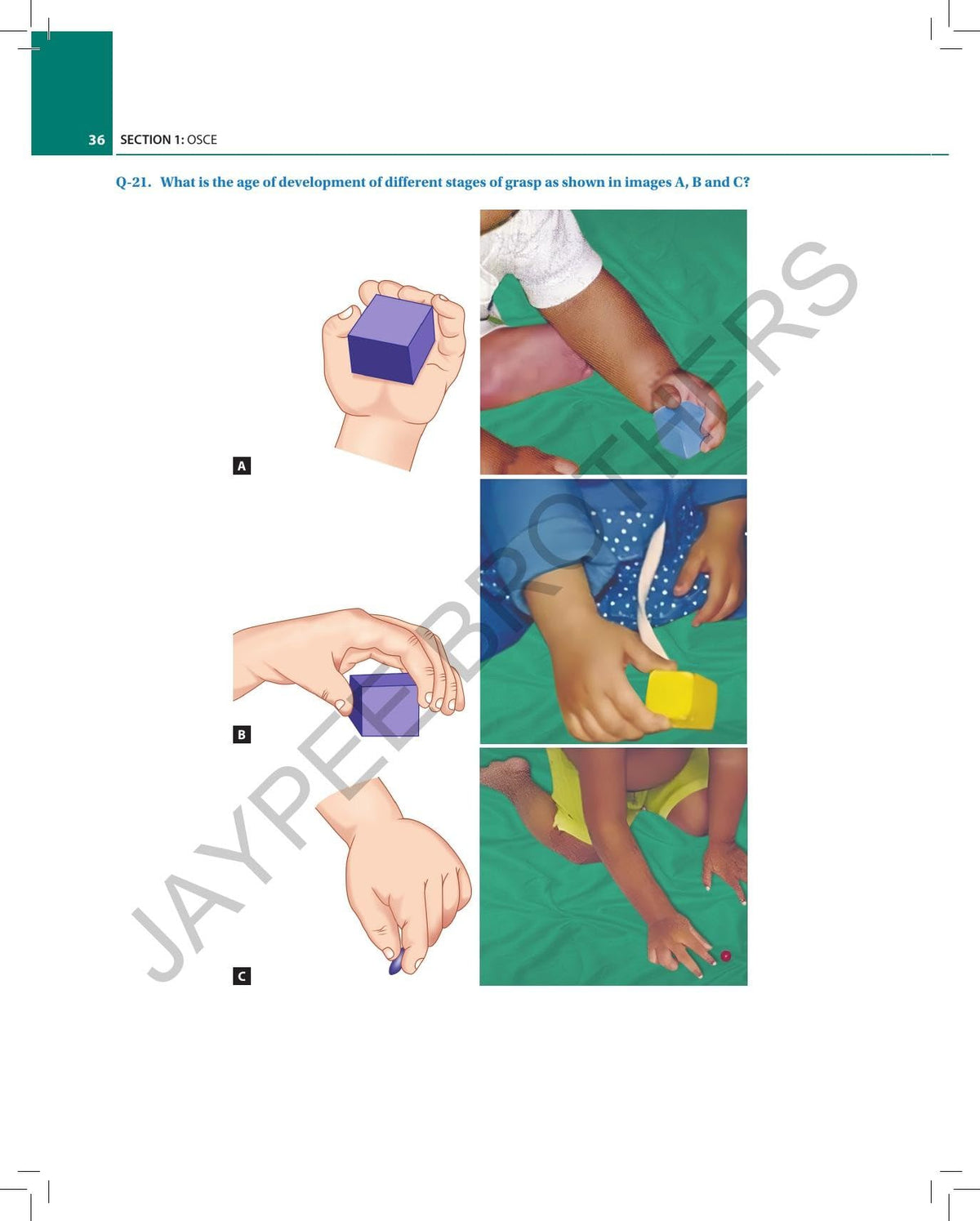 Essentials for PG Pediatric Exam: OSCE, Spotters, Viva and Procedures for DNB, MD, Diploma and MRCPCH Exams | 600+ OSCEs Across 26 Subjects | Spotter Diagnosis and Detailed Viva Q&A: 1