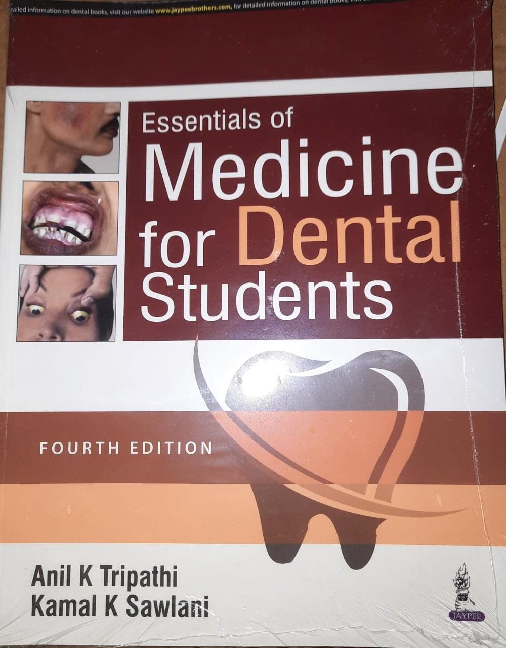 Essentials of Medicine for Dental Students, 4/E: General Medicine for BDS Students and Practicing Dentists | Medical Emergencies in Dental Practice, Preop Evaluation, MCQs