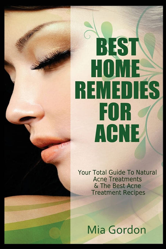 Best Home Remedies for Acne: Your Total Guide to Natural Acne Treatments & the Best Acne Treatment R book cover