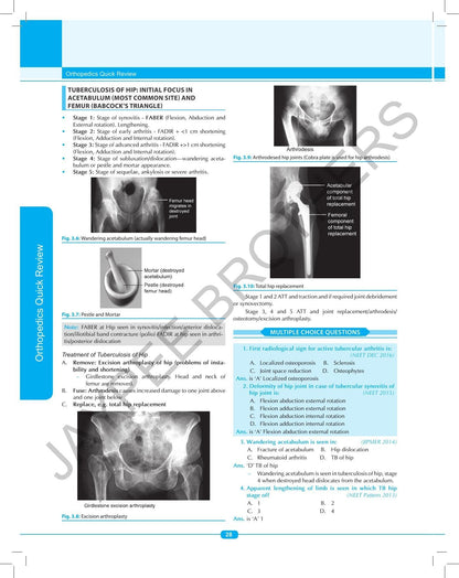 Orthopedics Quick Review (OPQR)