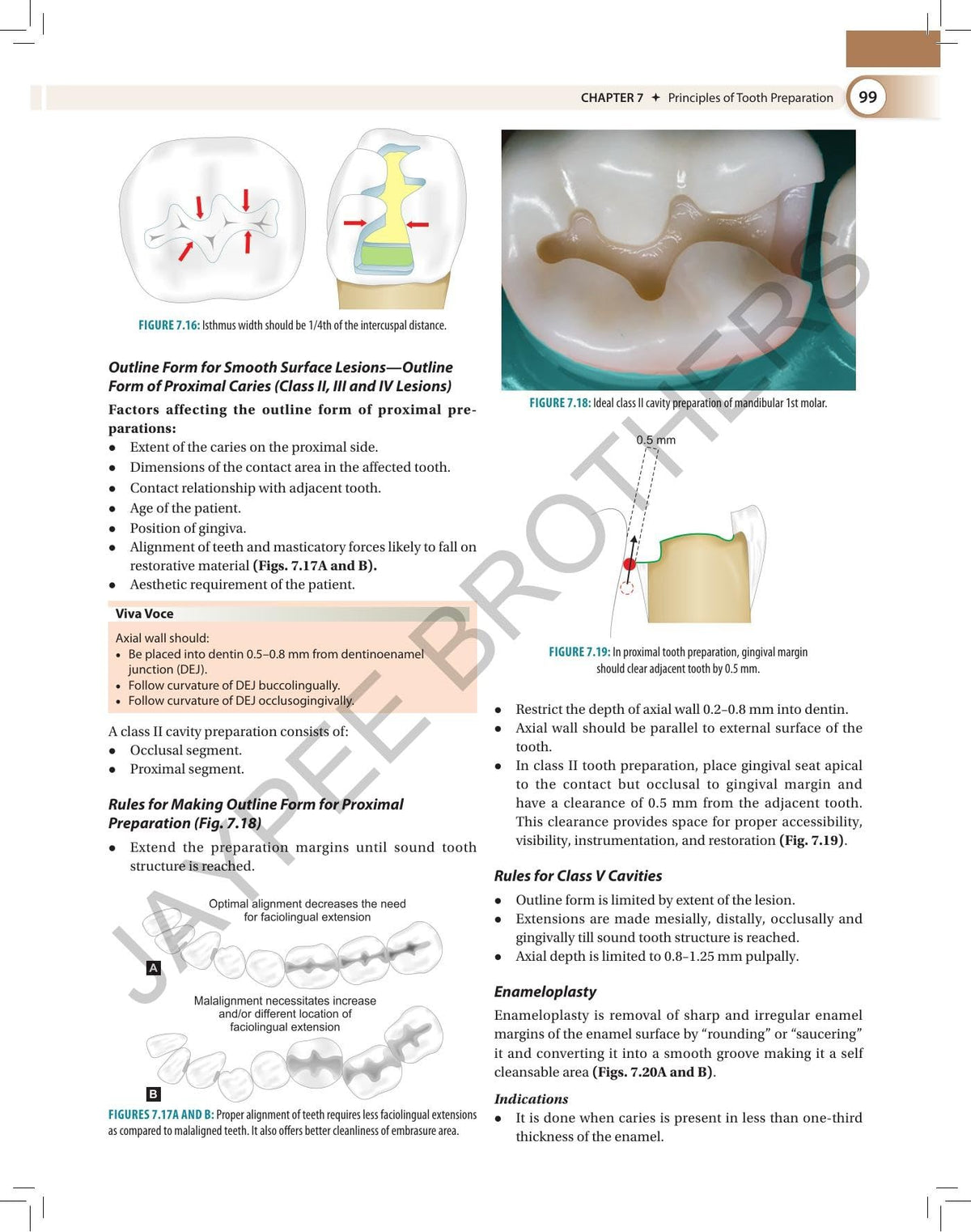 Textbook of Preclinical Conservative Dentistry, 4/E for 2nd Year BDS Students | Dental Caries, Materials, Cast Metal, Amalgam and Composite Restorations | Viva Questions and Glossary