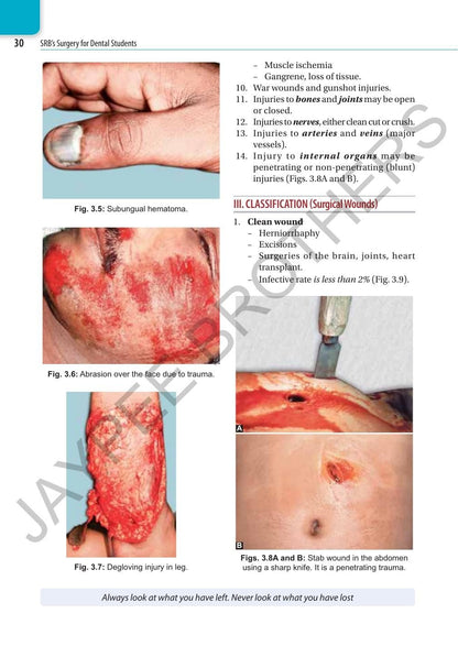 SRB's Surgery for Dental Students, 3/E for BDS Students | General Surgery Textbook with Head-Neck, Salivary Glands, Maxillofacial Injuries, Oral Cavity and Clinical Examination for Practicals