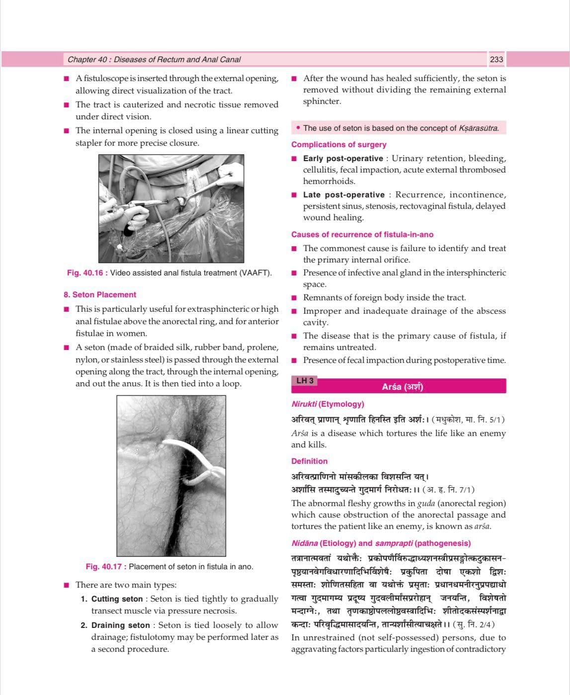 Illustrated Shalya Vigyan Part-2 (A Textbook of Ayurveda Surgery) Based on New NCISM Syllabus for BAMS Third Prof (English Medium)