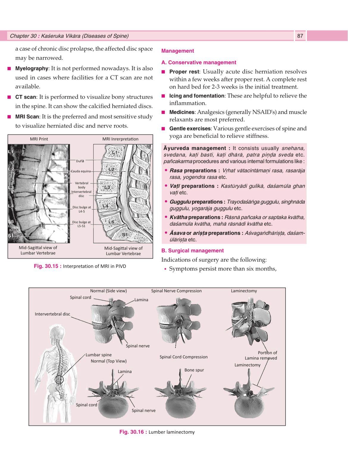 Illustrated Shalya Vigyan Part-2 (A Textbook of Ayurveda Surgery) Based on New NCISM Syllabus for BAMS Third Prof (English Medium)