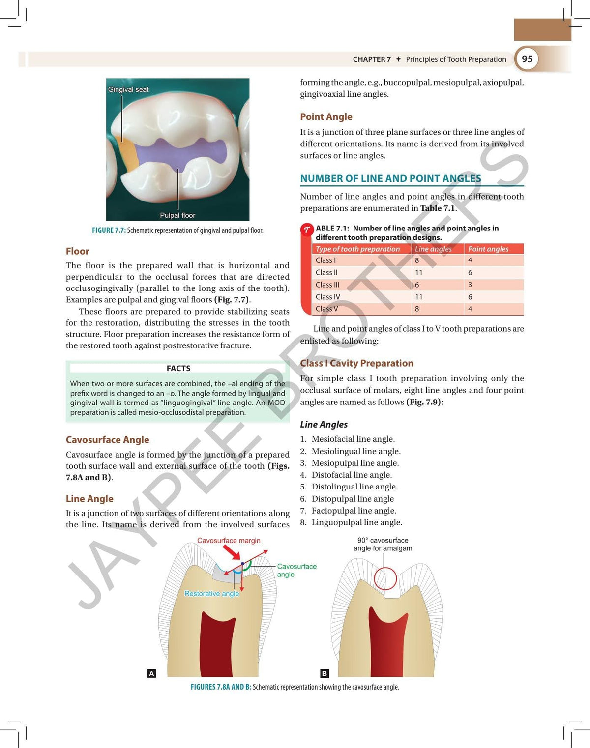 Textbook of Preclinical Conservative Dentistry, 4/E for 2nd Year BDS Students | Dental Caries, Materials, Cast Metal, Amalgam and Composite Restorations | Viva Questions and Glossary