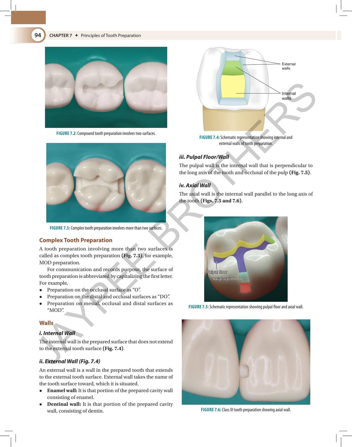 Textbook of Preclinical Conservative Dentistry, 4/E for 2nd Year BDS Students | Dental Caries, Materials, Cast Metal, Amalgam and Composite Restorations | Viva Questions and Glossary