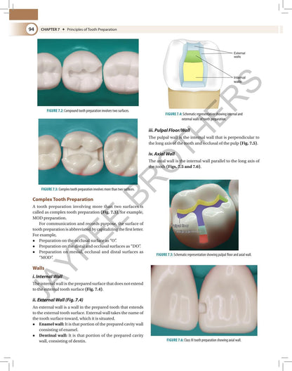 Textbook of Preclinical Conservative Dentistry, 4/E for 2nd Year BDS Students | Dental Caries, Materials, Cast Metal, Amalgam and Composite Restorations | Viva Questions and Glossary