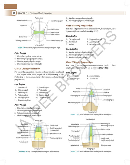 Textbook of Preclinical Conservative Dentistry, 4/E for 2nd Year BDS Students | Dental Caries, Materials, Cast Metal, Amalgam and Composite Restorations | Viva Questions and Glossary