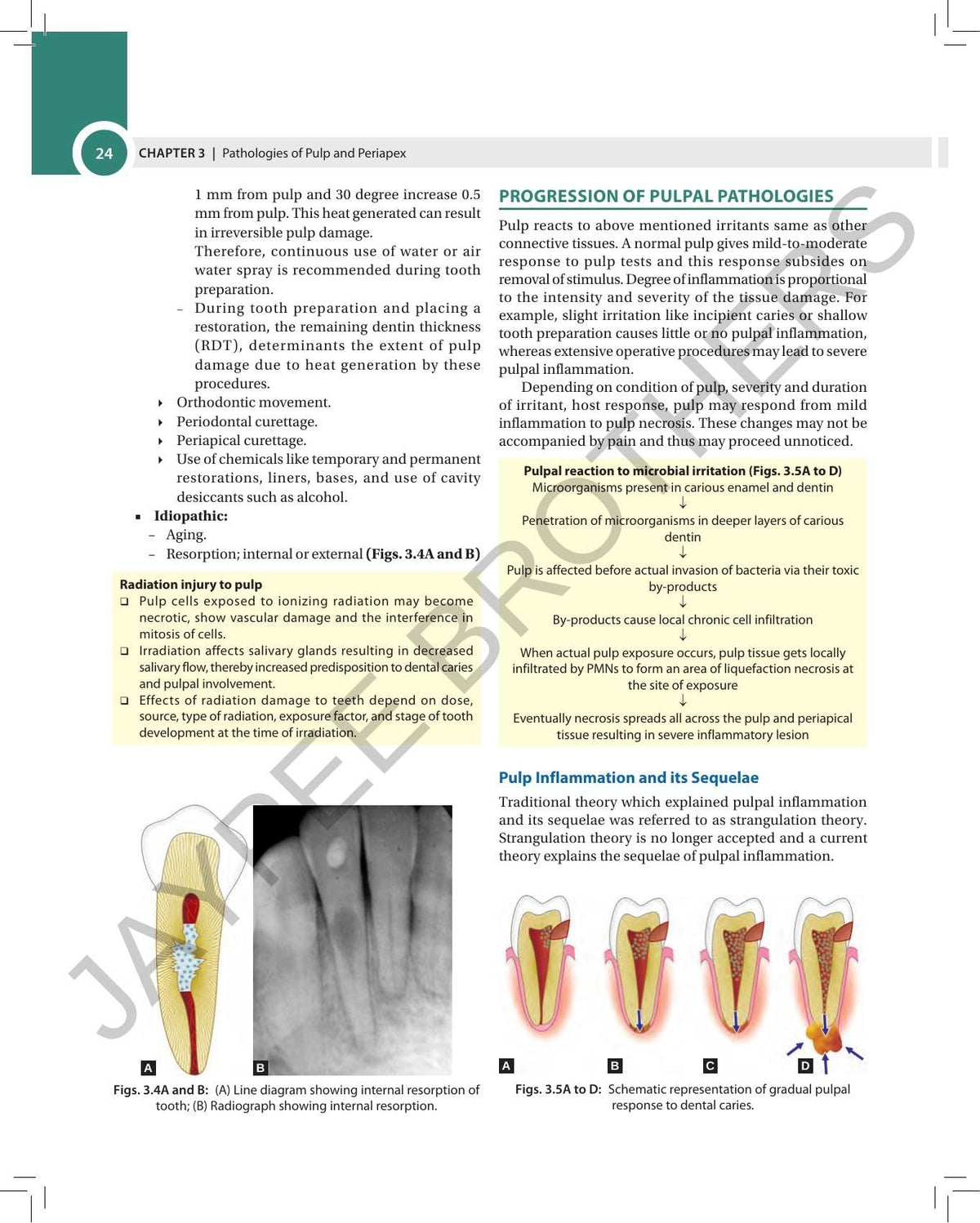 Textbook of Endodontics, 5/E for BDS, MDS Students and Practicing Dentists | Root Canal Guide with Rotary Instruments, Bioceramics, Vital Pulp Therapy | Chapter-wise University Exam Questions: 1