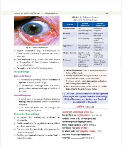 Illustrated Shalakya Tantra (Part-1 : Textbook of Ophthalmology) ???????-????? : ???-?? : ???????? ??????? (Hindi Edition) As per the new NCISM syllabus for BAMS Third Professional