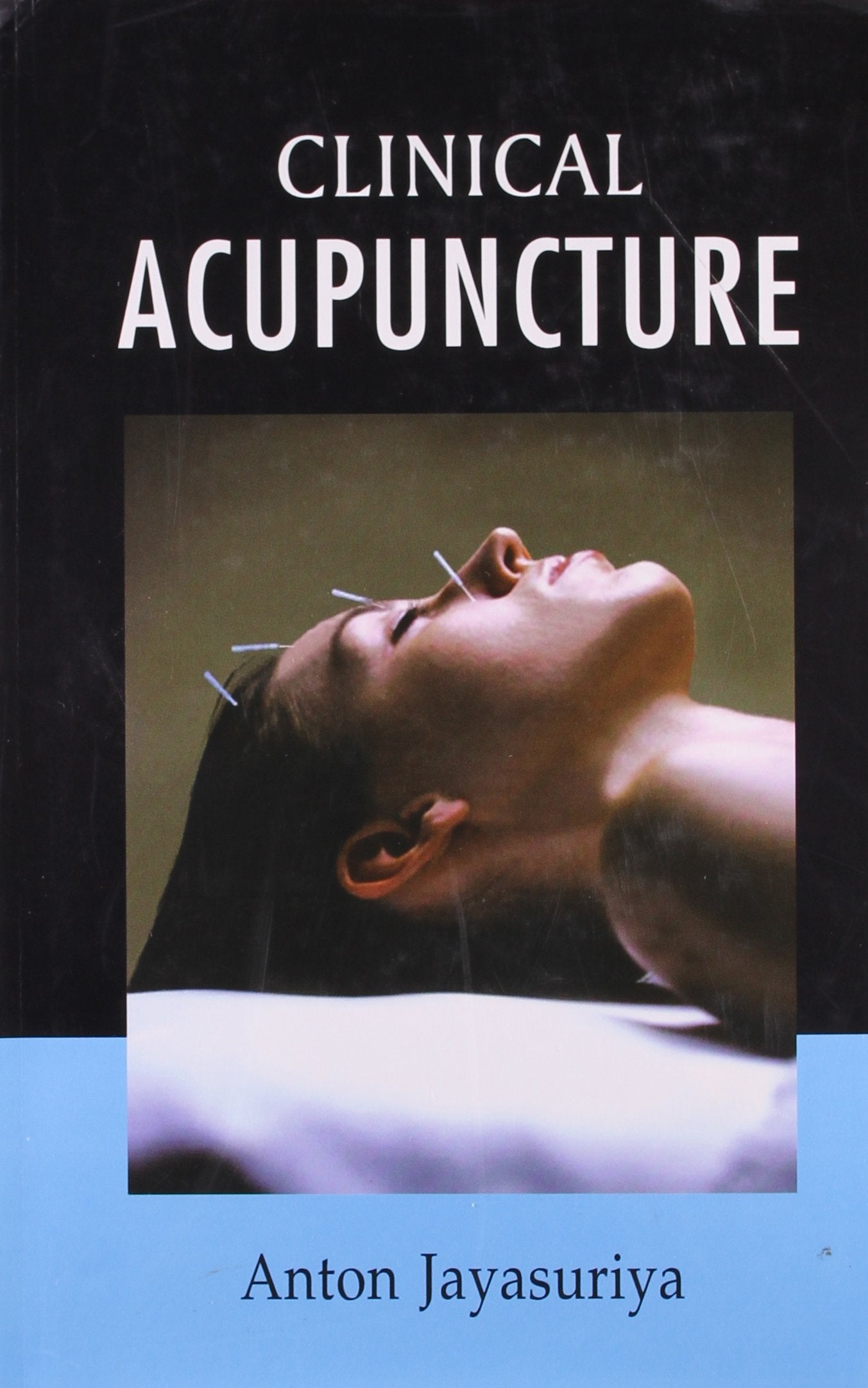 Clinical Acupuntcure book cover