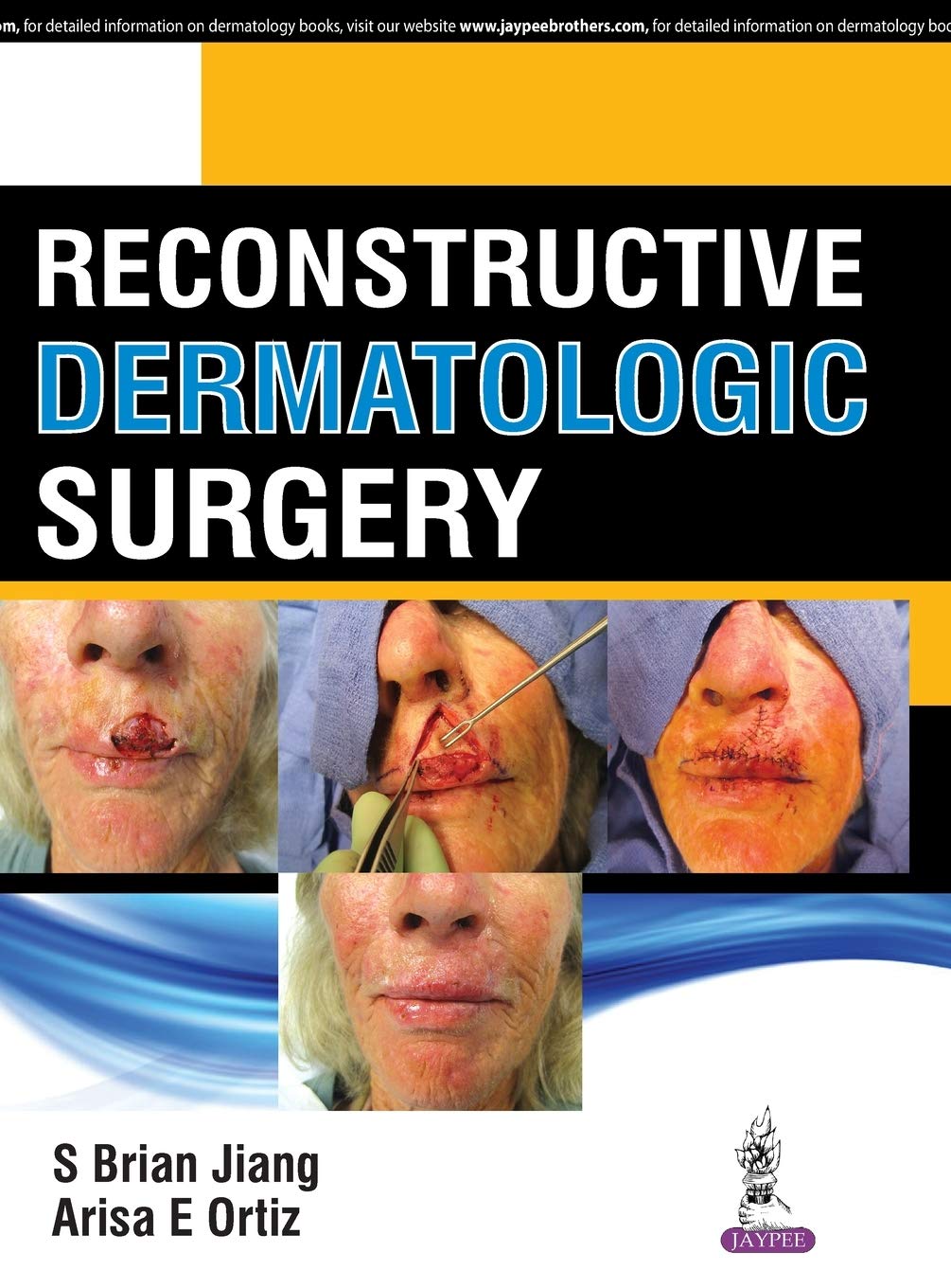 Reconstructive Dermatologic Surgery book cover