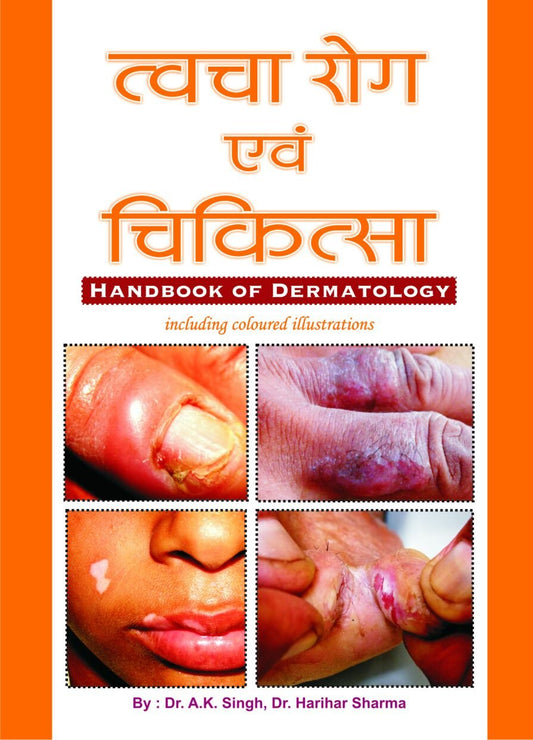 TWACHA ROG & CHIKITSA (HANDBOOK OF DERMATOLOGY) by Hindi Edition by Dr.A.K.SINGH (Author) Dr.HARIHAR SHARMA (Author) (Author) book cover