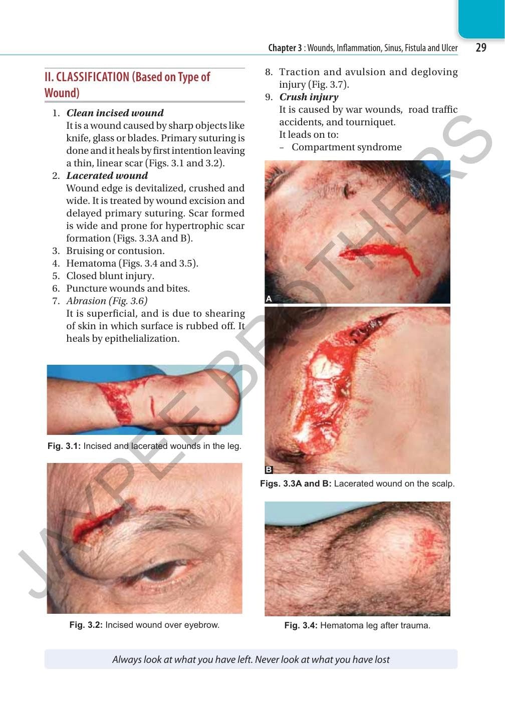 SRB's Surgery for Dental Students, 3/E for BDS Students | General Surgery Textbook with Head-Neck, Salivary Glands, Maxillofacial Injuries, Oral Cavity and Clinical Examination for Practicals