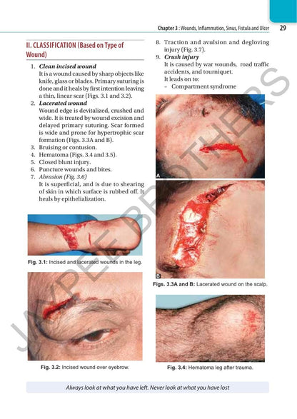 SRB's Surgery for Dental Students, 3/E for BDS Students | General Surgery Textbook with Head-Neck, Salivary Glands, Maxillofacial Injuries, Oral Cavity and Clinical Examination for Practicals