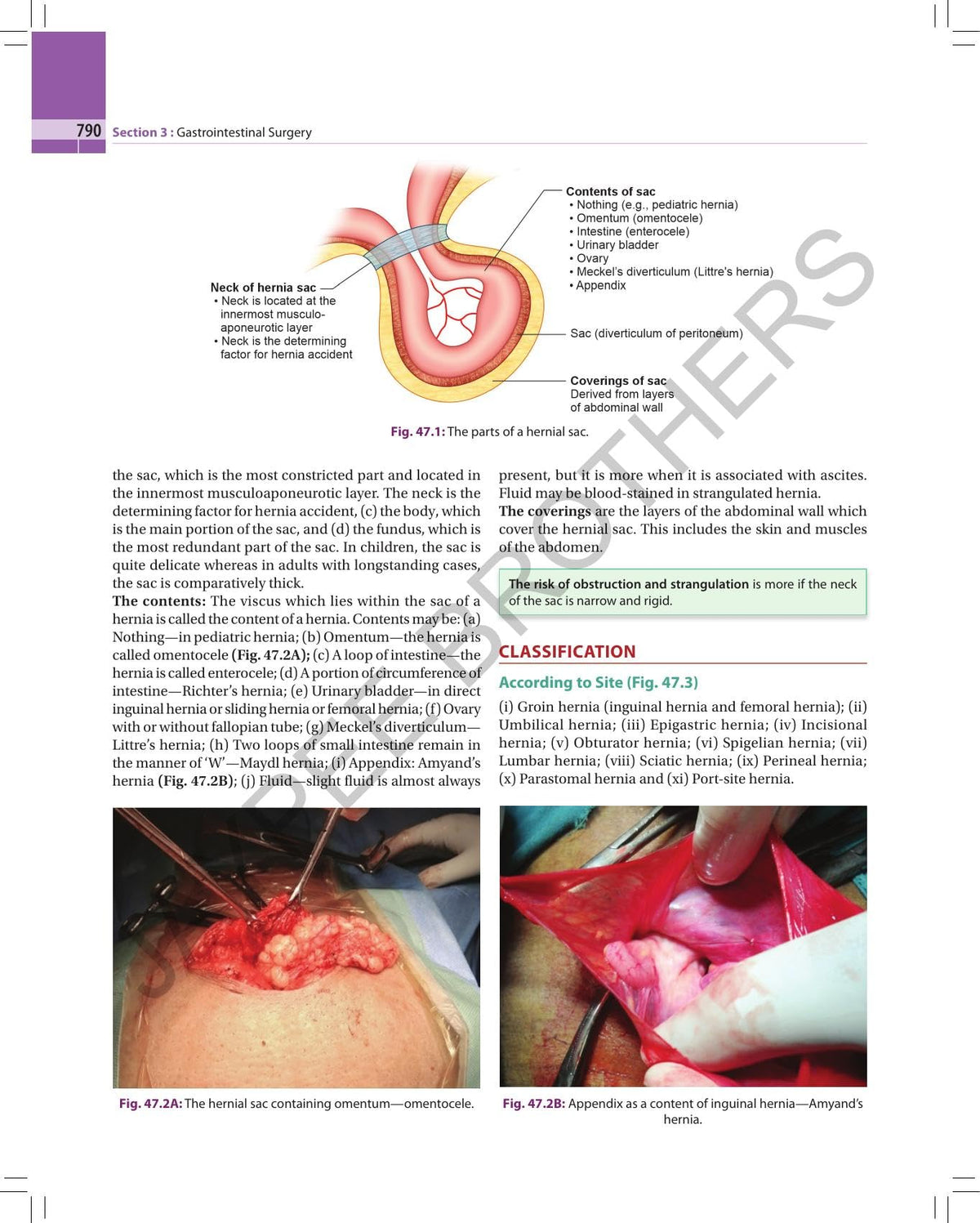 S Das Concise Textbook of Surgery, 12/E for MBBS Final Year Students | 1500+ MCQs with Answers, New Chapters on Oncology, Trauma and Anesthesia | NEET PG, INI-CET, FMGE Exam Prep: 1