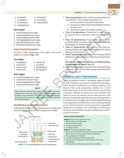 Textbook of Preclinical Conservative Dentistry, 4/E for 2nd Year BDS Students | Dental Caries, Materials, Cast Metal, Amalgam and Composite Restorations | Viva Questions and Glossary