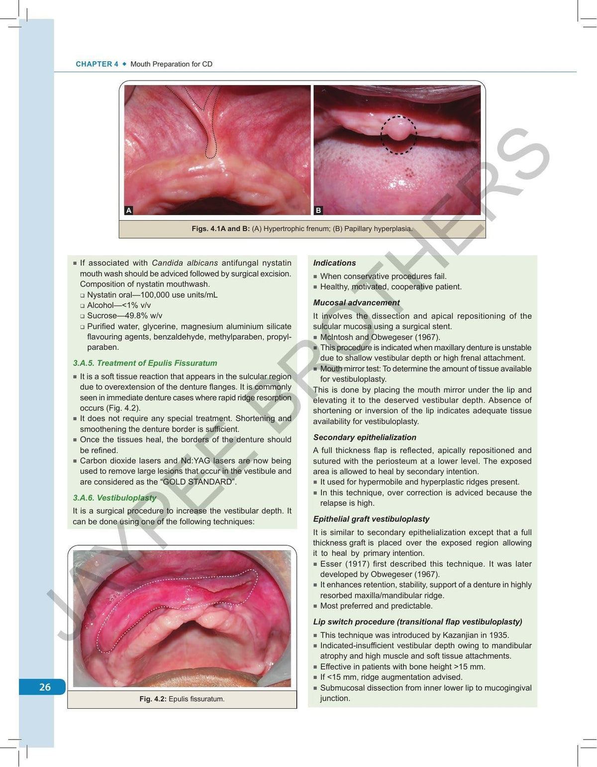 ESSENTIALS OF PROSTHODONTICS